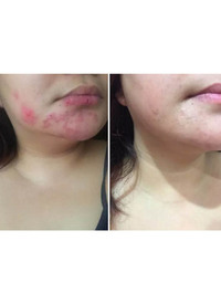 Vitamin E Repair and Recover Oil
