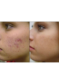 Vitamin E Repair and Recover Oil