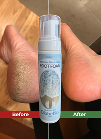 Ecoflex Foot Foam For Skin Regeneration 200ml
